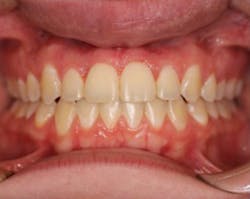 18feb8piaclintip07rev 18feb8piaclintip07rev