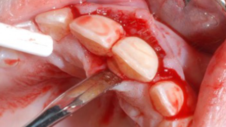 Content Dam Sr Online Articles 2018 02 18feb8piaclintipt