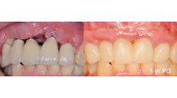 Content Dam Sr Online Articles 2018 02 18feb8pialint Content Dam Sr Online Articles 2018 02 18feb8pialint