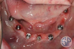 18mar8piagoberweitz02 18mar8piagoberweitz02