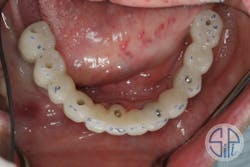 18mar8piagoberweitz03 18mar8piagoberweitz03