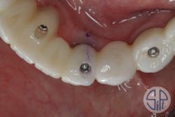 18mar8piagoberweitz05 18mar8piagoberweitz05