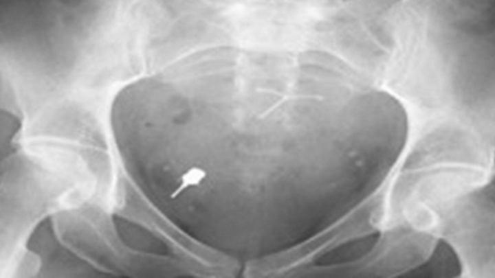 Content Dam Sr Online Articles 2018 04 18apr12piaclintipt