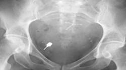 Content Dam Sr Online Articles 2018 04 18apr12piaclintipt Content Dam Sr Online Articles 2018 04 18apr12piaclintipt