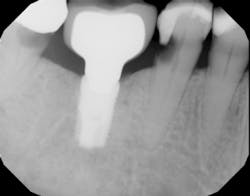 18may10piaclintip03 18may10piaclintip03