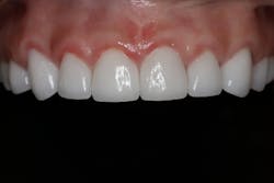 18may10piawei04 18may10piawei04