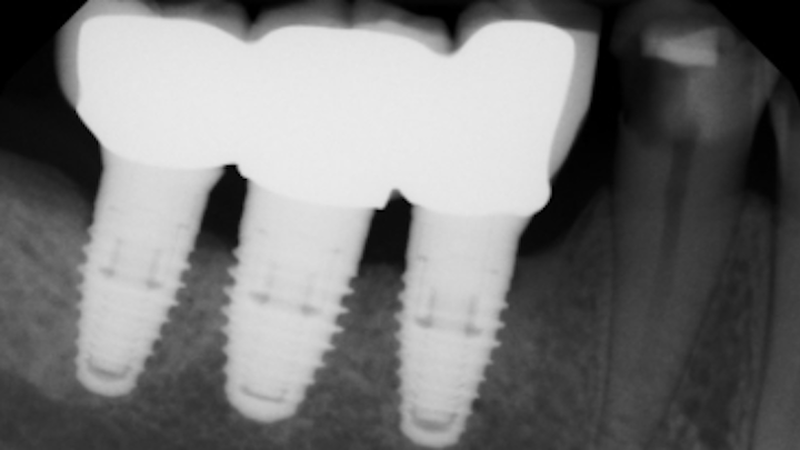 Content Dam Sr Online Articles 2018 05 18may10piaclintipt