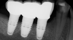 Content Dam Sr Online Articles 2018 05 18may10piaclintipt Content Dam Sr Online Articles 2018 05 18may10piaclintipt