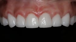 Content Dam Sr Online Articles 2018 05 18may10piaweit Content Dam Sr Online Articles 2018 05 18may10piaweit