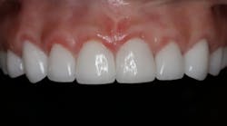 Content Dam Sr Online Articles 2018 05 18may10piaweit Content Dam Sr Online Articles 2018 05 18may10piaweit