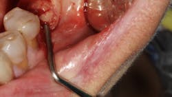 Content Dam Sr Online Articles 2018 06 18jun14piaclintipt Content Dam Sr Online Articles 2018 06 18jun14piaclintipt