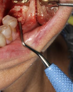 18jun14piaclintip02 18jun14piaclintip02