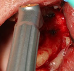 18jun14piaclintip04 18jun14piaclintip04