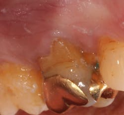 18jun14pialazarus01a 18jun14pialazarus01a