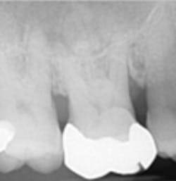 18jun14pialazarus01b 18jun14pialazarus01b