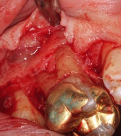 18jun14pialazarus02 18jun14pialazarus02