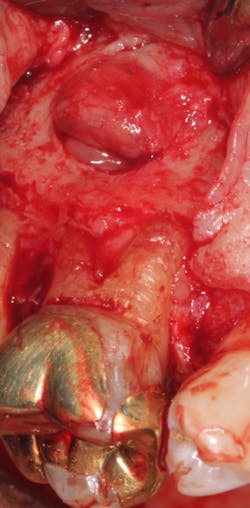 18jun14pialazarus03 18jun14pialazarus03