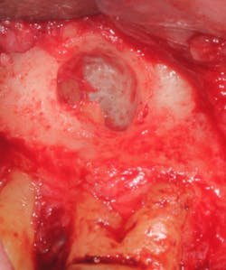 18jun14pialazarus04b 18jun14pialazarus04b