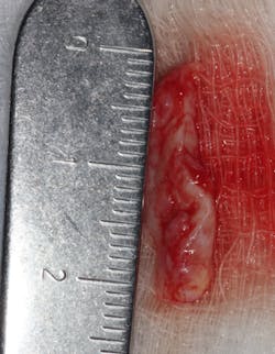 18jun14pialazarus05 18jun14pialazarus05