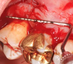 18jun14pialazarus06 18jun14pialazarus06