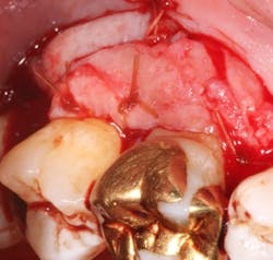 18jun14pialazarus07 18jun14pialazarus07