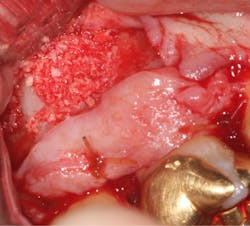 18jun14pialazarus08a 18jun14pialazarus08a