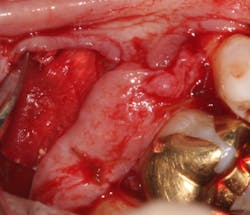 18jun14pialazarus08b 18jun14pialazarus08b