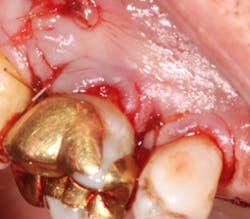 18jun14pialazarus09 18jun14pialazarus09