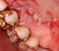 18jun14pialazarus10 18jun14pialazarus10