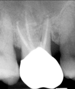 18jun14pialazarus11 18jun14pialazarus11