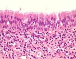 18jun14pialazarus12 18jun14pialazarus12