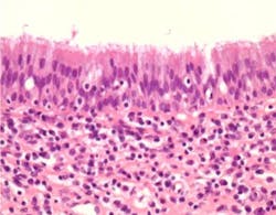 18jun14pialazarus12 18jun14pialazarus12