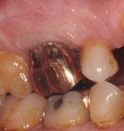 18jun14pialazarus13 18jun14pialazarus13