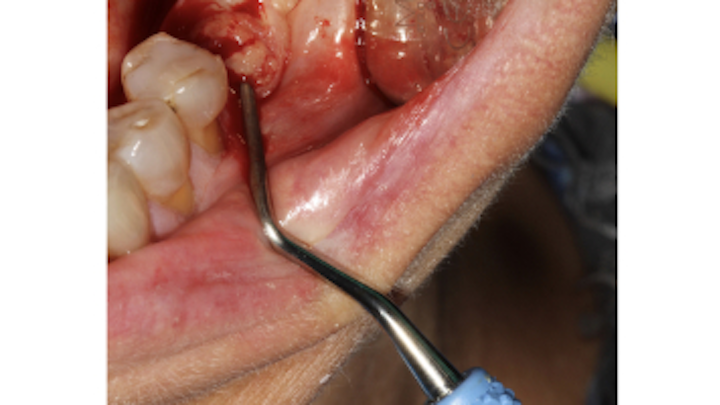 Content Dam Sr Online Articles 2018 06 18jun14piaclintipt
