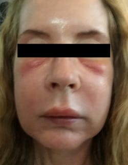 18jul12piaclintip02 18jul12piaclintip02