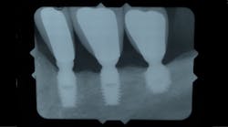 Content Dam Sr Online Articles 2018 07 18jul12piaclintipt Content Dam Sr Online Articles 2018 07 18jul12piaclintipt