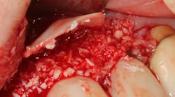 Content Dam Sr Online Articles 2018 07 18jul12piasummerfordt Content Dam Sr Online Articles 2018 07 18jul12piasummerfordt