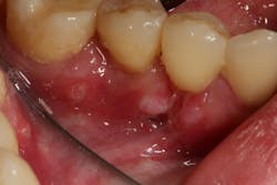 18aug9piaclintip02 18aug9piaclintip02