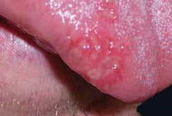 18aug9piaclintip03 18aug9piaclintip03