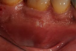 18aug9piaclintip05 18aug9piaclintip05