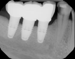 18aug9pianeymark03a 18aug9pianeymark03a