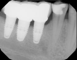 18aug9pianeymark03b 18aug9pianeymark03b