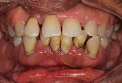 The new classification of periodontal disease that you, your patient ...
