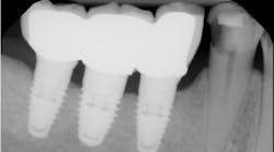 Content Dam Sr Online Articles 2018 08 18aug9pianeymarkt Content Dam Sr Online Articles 2018 08 18aug9pianeymarkt