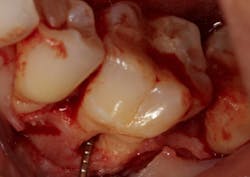 18oct11piaclintip01a 18oct11piaclintip01a