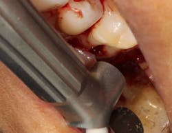 18oct11piaclintip02 18oct11piaclintip02