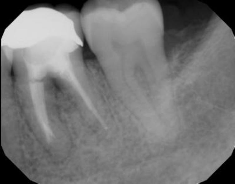 18oct11piaclintip04