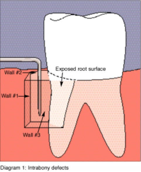 18oct11piaclintip05