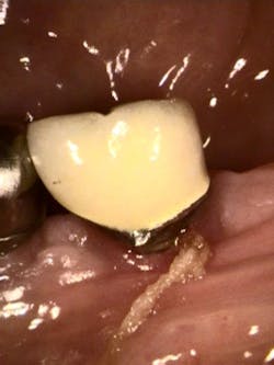 18oct11piahealy01 18oct11piahealy01