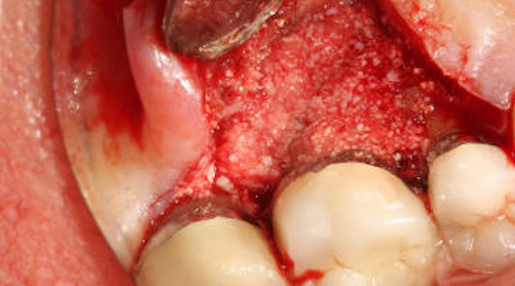 Content Dam Sr Online Articles 2018 10 18oct11piaclintipt
